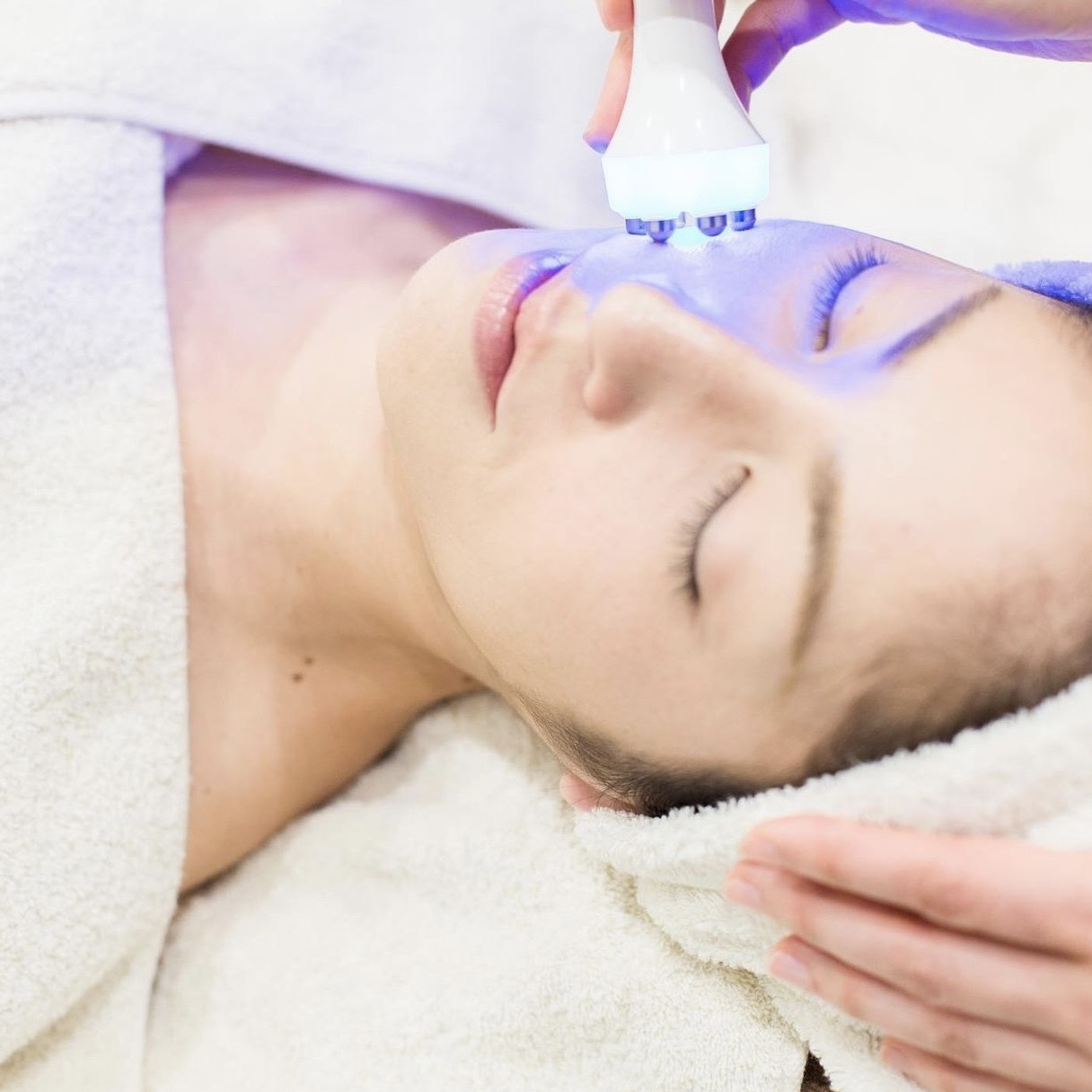 ポレーション導入